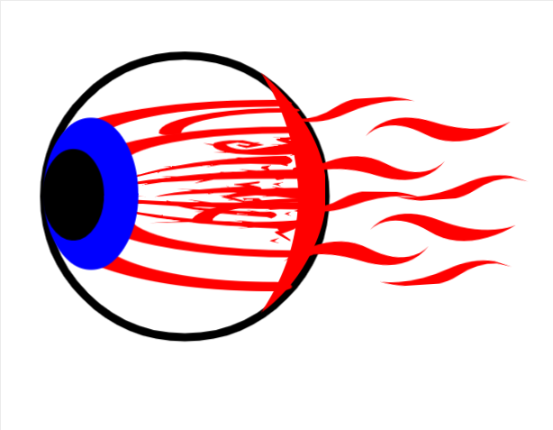 wandering eye
